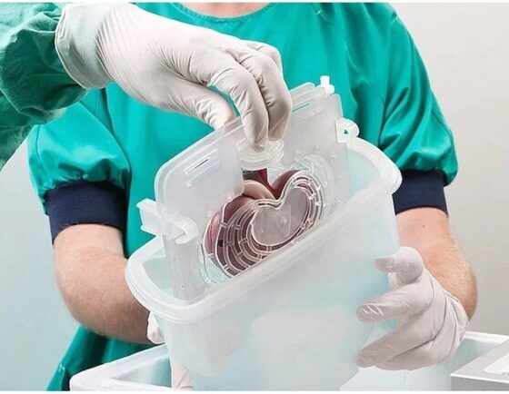 Development of Transplantology and Biotechnology in Ukraine