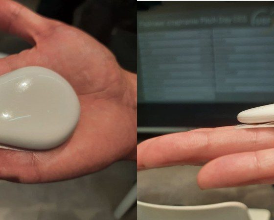 Ukrainians Device for Remote Monitoring of the Heart