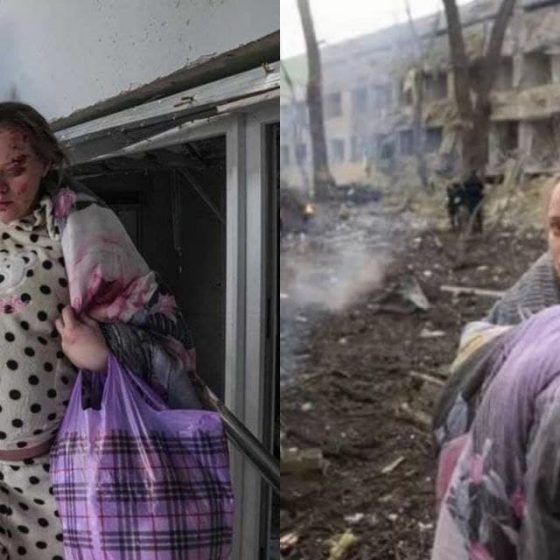 Russian People Attacked Pregnant Girl