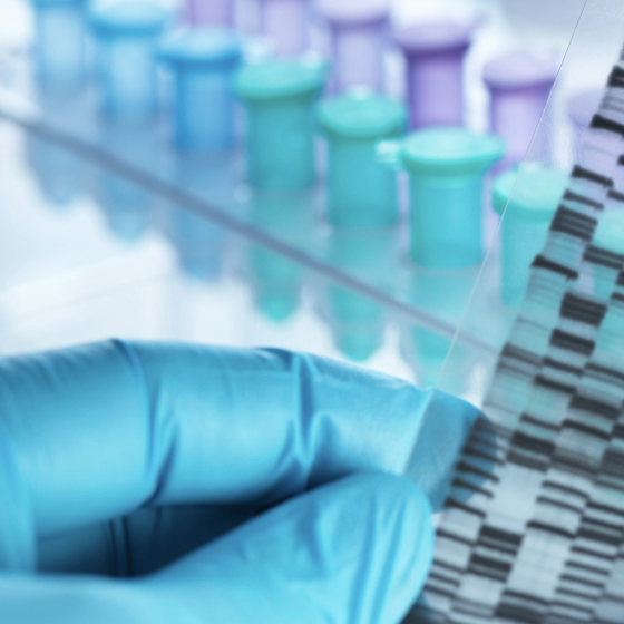 France Sent Mobile DNA Laboratories “LAB’ADN” to Ukraine