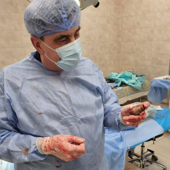 Ukrainian Surgeons Recover Unexploded Grenade From Soldier’s Body