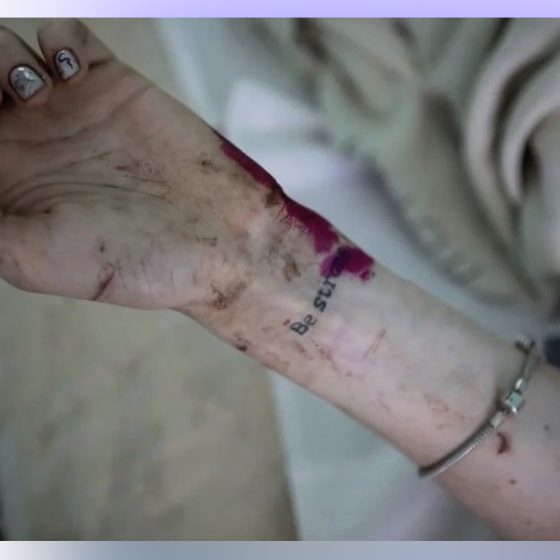 The Bloodiest Russian Terrorist Attacks in 345 Days