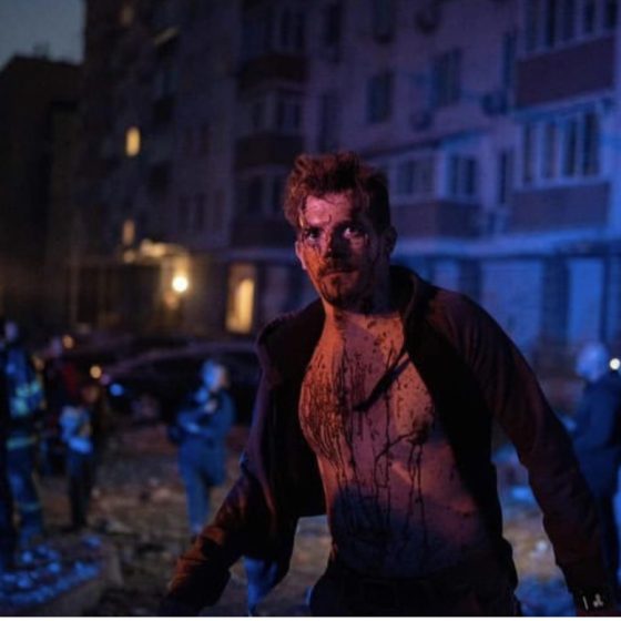 RU Missile Shelling of Kyiv. May 30. Killed People. Photos