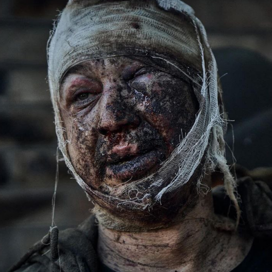 The Pain of Ukraine Presented at the Photoexhibition in France